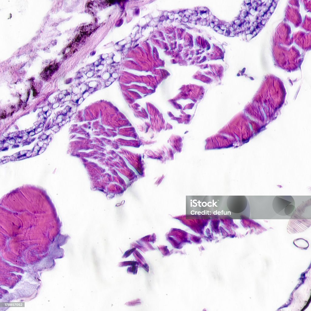 micrograph of insects body cross section, moth caterpillar science micrograph of insects body cross section, moth caterpillar prodenia litura, with HE dye. Animal Stock Photo