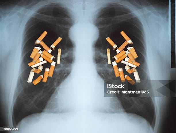 Lung Cancer Stock Photo - Download Image Now - Addiction, Adult, Brown