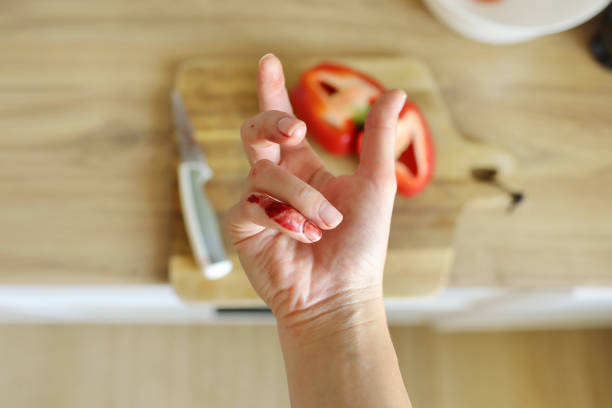 Dieta para curar feridas: acelere a cicatrização! - receita deliciosa profissional - passo 2