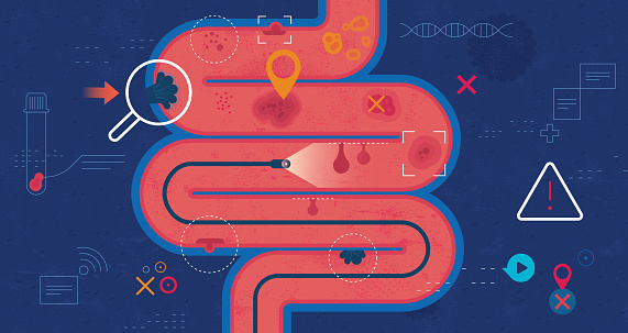 Flat vector illustration with hand drawn textures depicting the colonoscopy screening test detecting different colon health conditions and diseases.