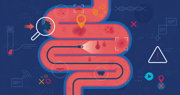 Colonoscopy Screening Test Flat vector illustration with hand drawn textures depicting the colonoscopy screening test detecting different colon health conditions and diseases. colon stock illustrations