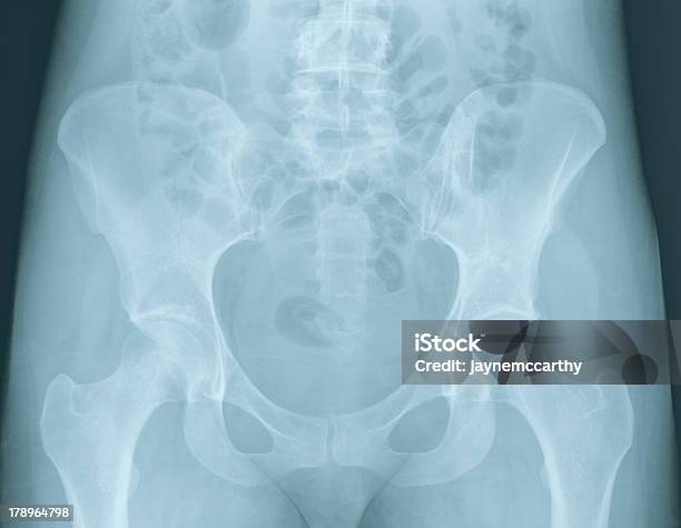 Fêmea Pélvis Radiografia - Fotografias de stock e mais imagens de Imagem de raios X - Imagem de raios X, Útero Humano, Virilha Humana