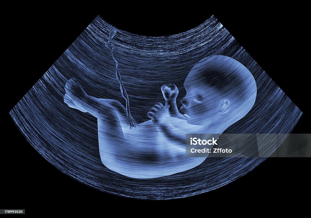 ultrasound baby Ultrasound image of baby in mother's womb Human Embryo Stock Photo