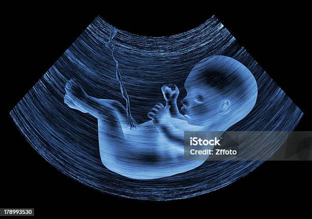 Ultrasound Baby Stock Photo - Download Image Now - Human Embryo, Fetus, Ultrasound