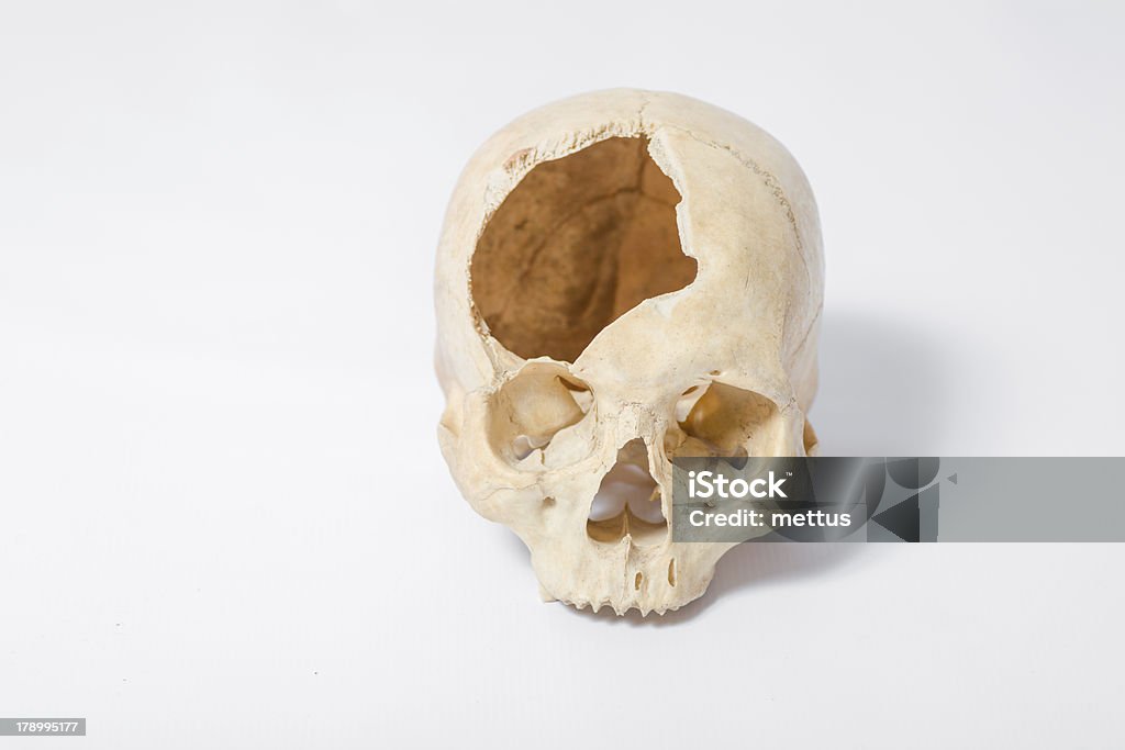 Side view of human skull Side view of human skull on white Absence Stock Photo