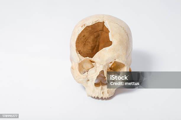 Side View Of Human Skull Stock Photo - Download Image Now - Absence, Anatomy, Care