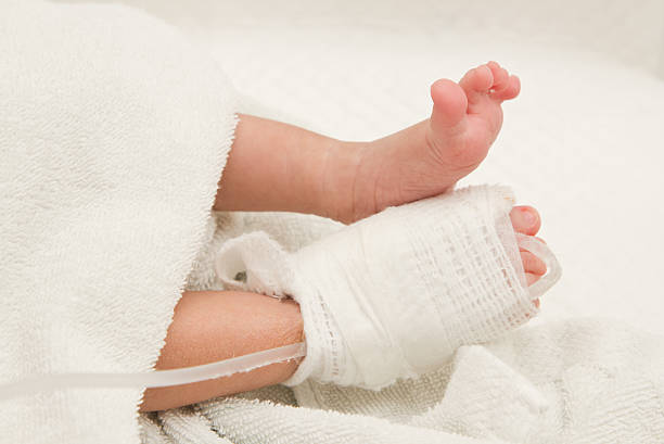 Intra venous fluid line at foot of new born patient Intra venous fluid line at foot of new born patient baby dextrose stock pictures, royalty-free photos & images