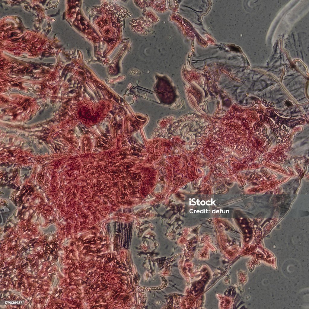 исследовательская микрофотография от насекомых тела cross section, Гусеница моли - Стоковые фото Безпозвоночное роялти-фри