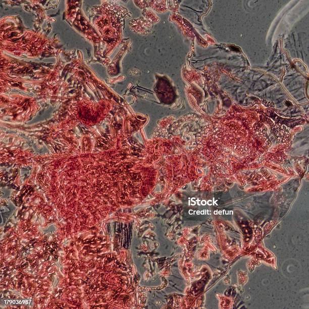 Исследовательская Микрофотография От Насекомых Тела Cross Section Гусеница Моли — стоковые фотографии и другие картинки Безпозвоночное