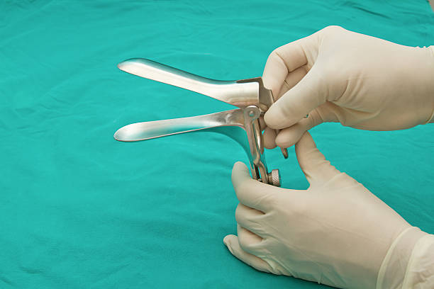 médico de la mano graping ginecológica espéculo - espéculo fotografías e imágenes de stock
