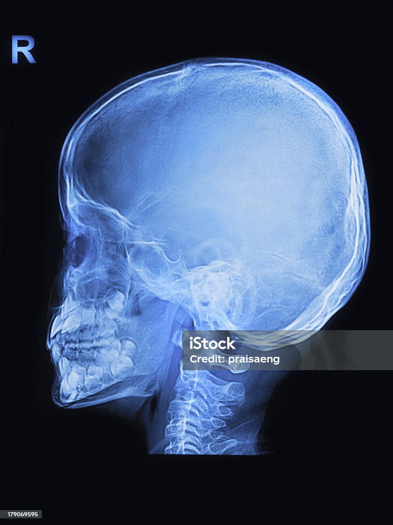 Bambini teschio di raggi x immagine - Foto stock royalty-free di Anatomia umana
