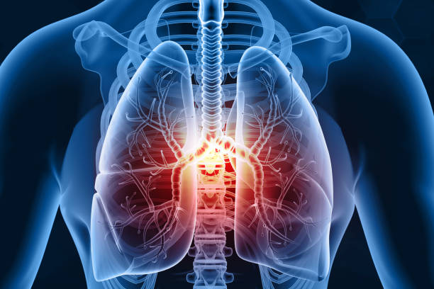 istock Human lungs diseases, lungs pain 1790770343