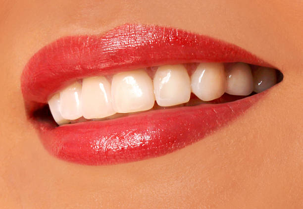istock woman smile. white teeth. dental care 179092070