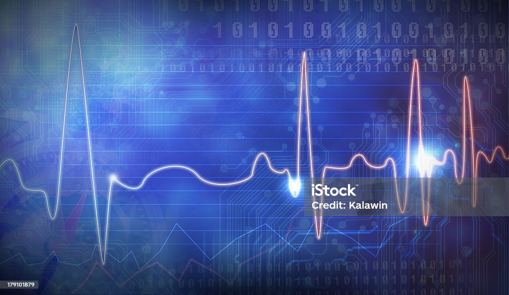 , EEG - Foto de stock de Electroencefalograma libre de derechos