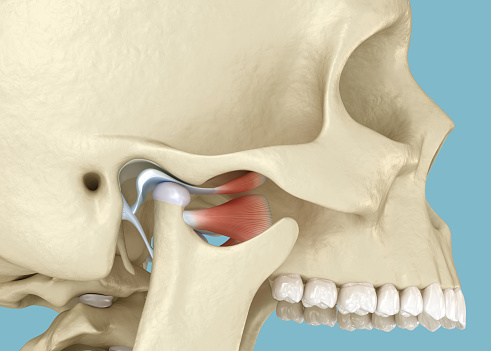 TMJ: The temporomandibular joints dislocation. 3D illustration.