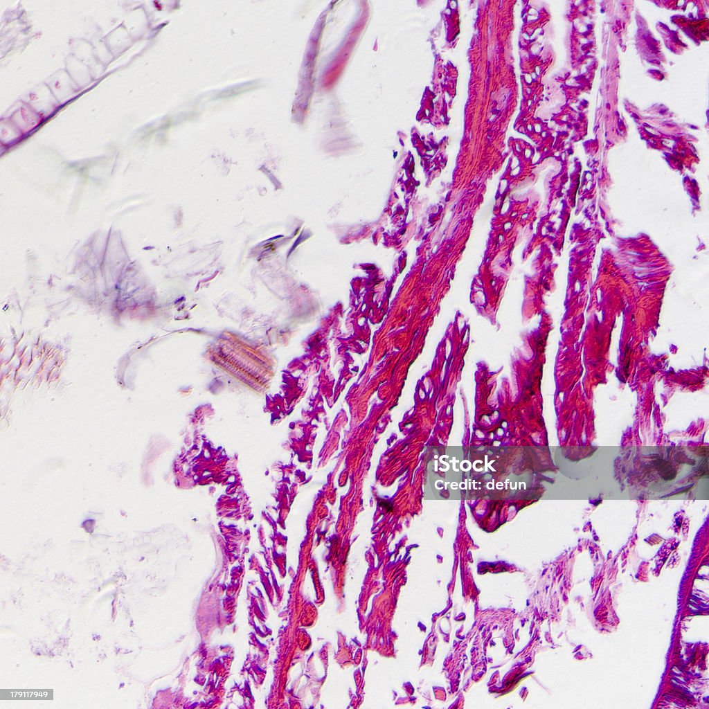 Micrografía de insectos cuerpo sección transversal, oruga de mariposa nocturna - Foto de stock de Animal libre de derechos