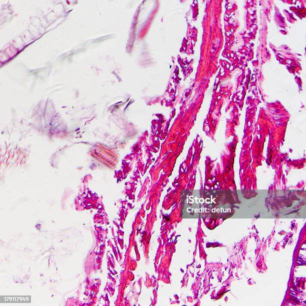 Micrografía De Insectos Cuerpo Sección Transversal Oruga De Mariposa Nocturna Foto de stock y más banco de imágenes de Animal