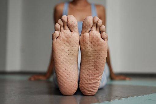 Front view closeup of female feet with nail board markings in yoga studio, copy space