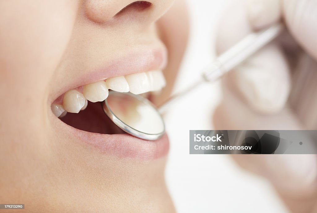Mouth care Close-up of human open mouth during oral checkup at the dentists Care Stock Photo