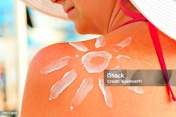 Protective Sun Cream On A Womans Shoulder Stock Photo - Download Image Now - Sunburned, Activity, Adult