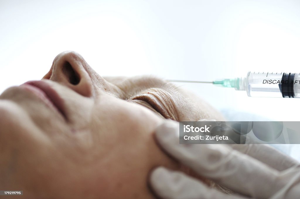 Iniezione di Botox sul viso pelle - Foto stock royalty-free di 60-69 anni