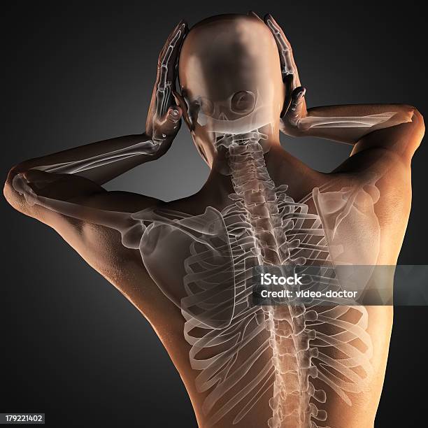 Radiografía Humanos Barrido Foto de stock y más banco de imágenes de Adulto - Adulto, Anatomía, Articulación