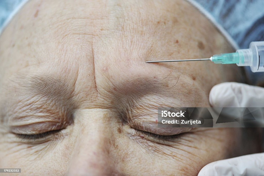 Invecchiato donna ricevendo iniezione di botox sulla fronte - Foto stock royalty-free di 60-69 anni