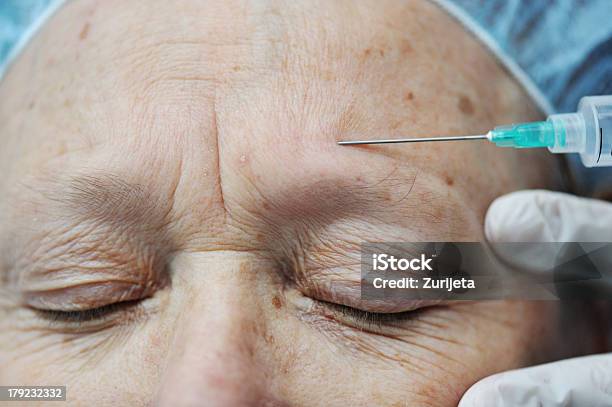 Idoso Mulher A Receber Injeção De Botox Na Testa - Fotografias de stock e mais imagens de 50 Anos - 50 Anos, 60-69 Anos, Adulto