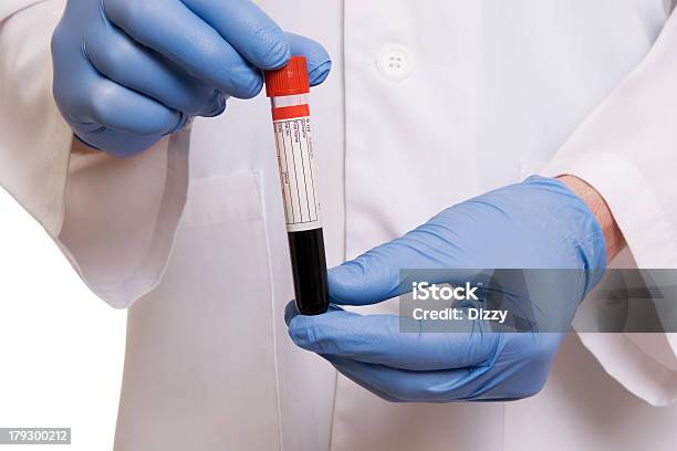 Blood Test Stockfoto und mehr Bilder von Blut - Blut, Bluttest, Eine Person