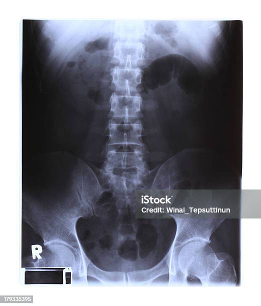 X레이 필름을 척추 및 골반 X-레이에 대한 스톡 사진 및 기타 이미지 - X-레이, 건강 진단, 건강관리와 의술
