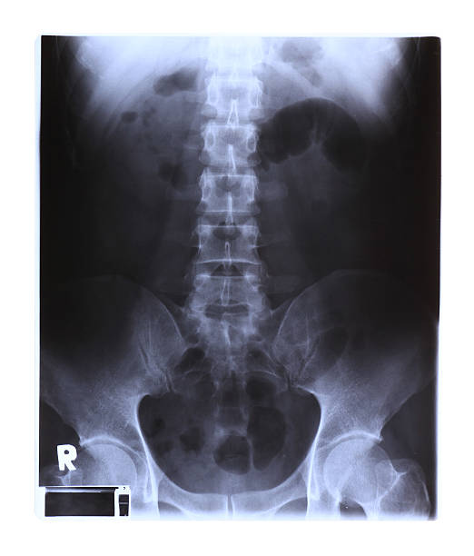 istock X-ray film of spinal column and pelvis 179335395