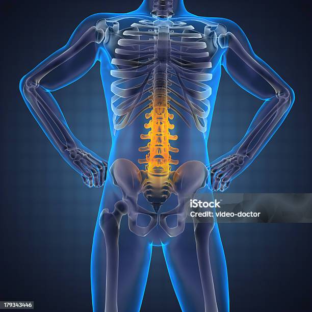 Radiografia Umano Scansione - Fotografie stock e altre immagini di Adulto - Adulto, Anatomia umana, Artrite