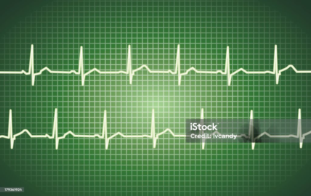 Cardiogram - Vetor de Doença do coração royalty-free