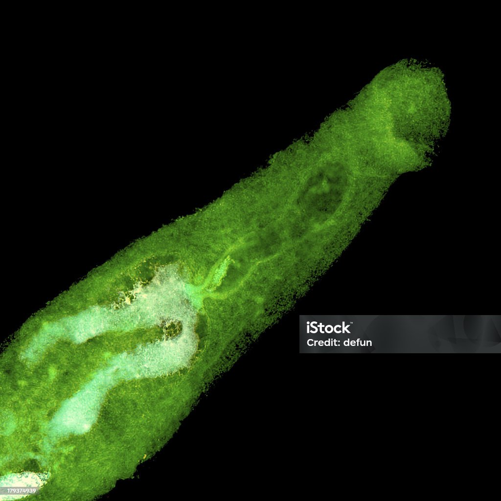 動物の血液 flukes parasiteras schistosome - 住血吸虫症のロイヤリティフリーストックフォト