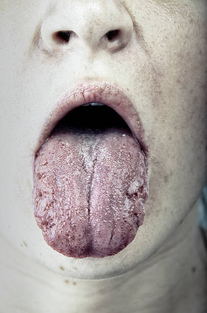 istock sick women showing her tongue 179376701