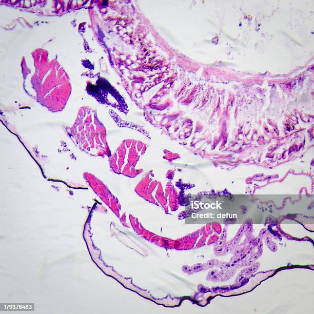 Larva Di Falena Corpo Micrografia La Sezione Trasversale - Fotografie stock e altre immagini di Anellide