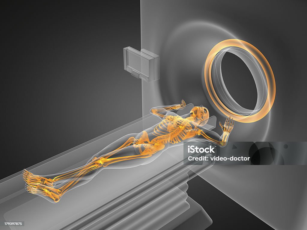 MRI 검사 - 로열티 프리 MRI 스캐너 스톡 사진