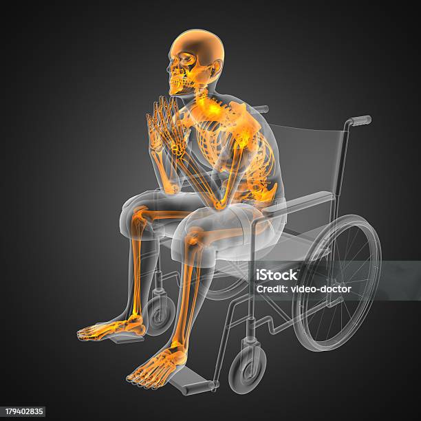 Uomo In Sedia A Rotelle - Fotografie stock e altre immagini di Sedia a rotelle - Sedia a rotelle, Immagine a raggi X, Radiografia
