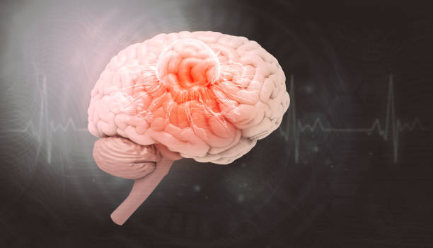 istock Human brain cancer concept 1794395445