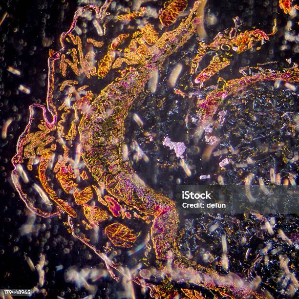蛾の幼虫ボディ断面顕微鏡写真です - スクエアのストックフォトや画像を多数ご用意 - スクエア, ピンク色, ヘビ