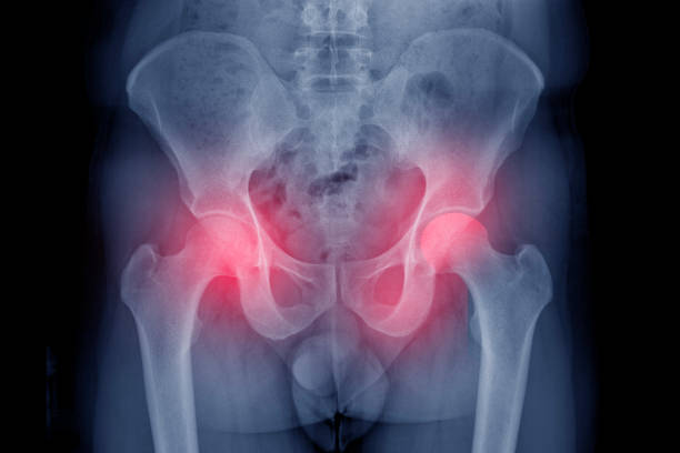 istock Film x-ray human's pelvis 1794671791
