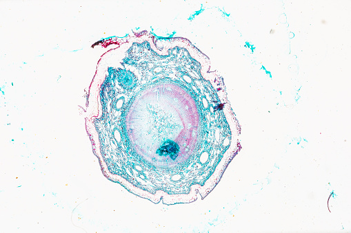 Cyst of Balamuthia mandrillaris amoeba, 3D illustration. A free-living protozoan in soil and water, can cause granulomatous amoebic encephalitis. Both cysts and trophozoites are infectious forms for humans