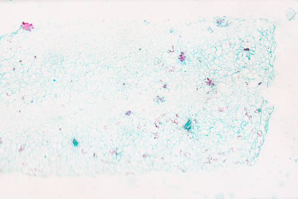 roślina pometomato flesh w.m. pod światło mirkoskop na białym tle - ciliata zdjęcia i obrazy z banku zdjęć
