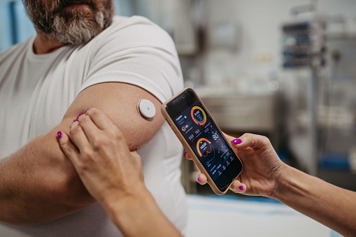 Doctor connecting patient's continuous glucose monitor with smartphone, to check his blood sugar level in real time. Obese, overweight man is at risk of developing type 2 diabetes. Concept of health risks of overwight and obesity.
