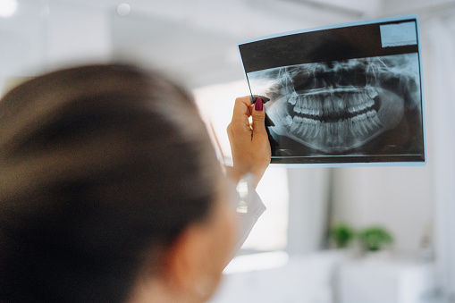 Dentist woman looking at an x-ray