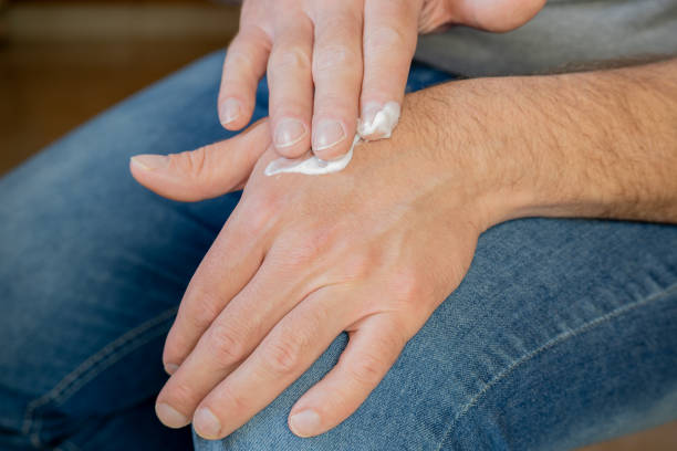 istock Hands of a man applying cream. 1799475652
