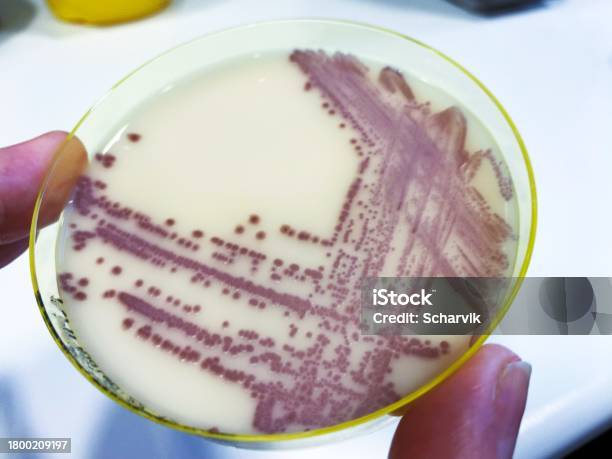 Krusei Candida Krusei Grown On Chrom Agar Stock Photo - Download Image Now ...