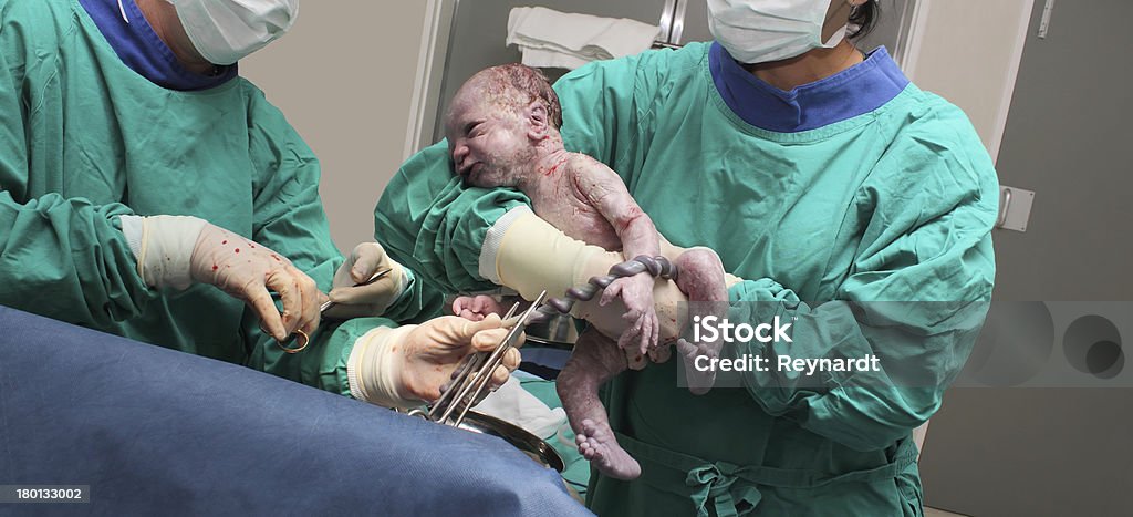 New born Baby with umbilical cord A doctor holds a new born baby whilst another doctor cuts the Umbilical cord. Caesarean Section Stock Photo