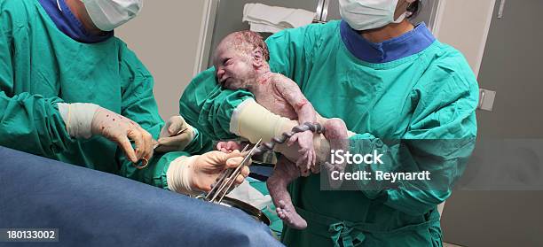 New Born Baby With Umbilical Cord Stock Photo - Download Image Now - Caesarean Section, Childbirth, New Life
