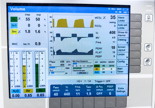 Hospital monitor displaying vital signs: heart rate, blood pressure, oxygenation, temperature, and end-tidal CO2, crucial for patient care and health assessment